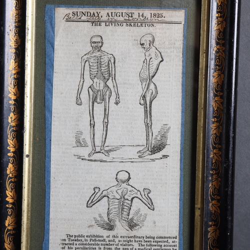 3407 - Curiosity/Macabre : a 19th century newspaper cutting, August 14, 1825, 'The Living Skeleton', the na... 