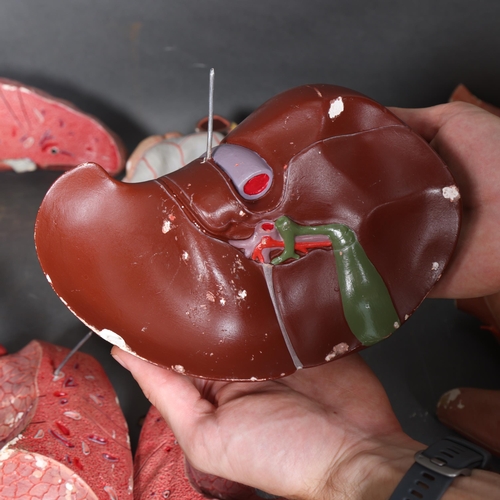 Adam Rouilly - An impressive life-sized anatomical male torso and head ...