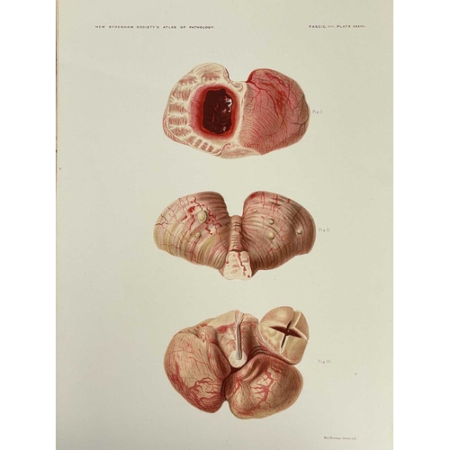 443 - Atlas of Illustrations of Pathology Four issues Fasciculus VII, VIII, IX and X, original envelopes w... 