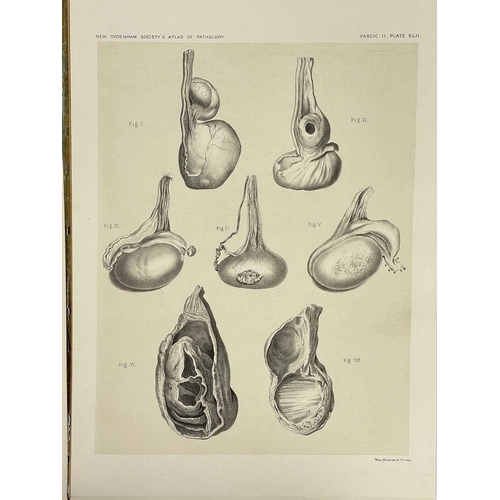 443 - Atlas of Illustrations of Pathology Four issues Fasciculus VII, VIII, IX and X, original envelopes w... 