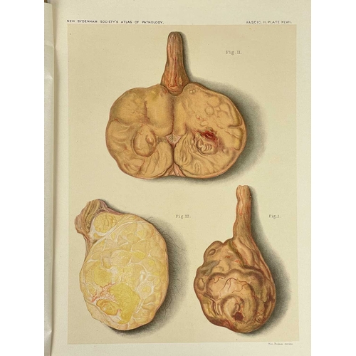 443 - Atlas of Illustrations of Pathology Four issues Fasciculus VII, VIII, IX and X, original envelopes w... 