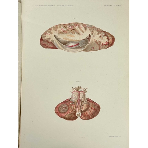 443 - Atlas of Illustrations of Pathology Four issues Fasciculus VII, VIII, IX and X, original envelopes w... 