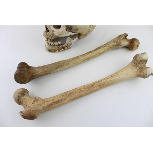 29 - Early c19th real human skull together with two antique human femur bones as anatomical specimens (3)... 