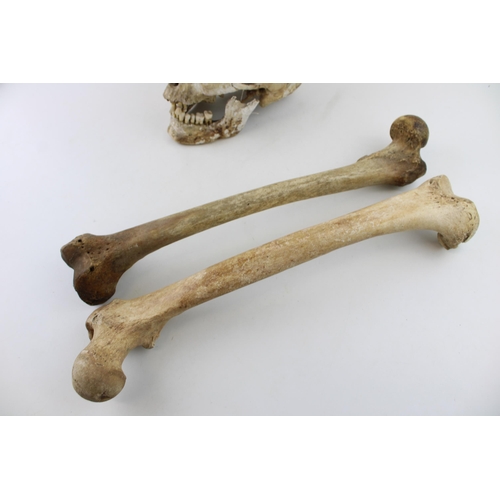 29 - Early c19th real human skull together with two antique human femur bones as anatomical specimens (3)... 