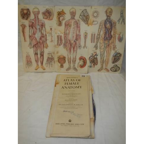 229 - An Atlas of Female Anatomy, in poor condition.