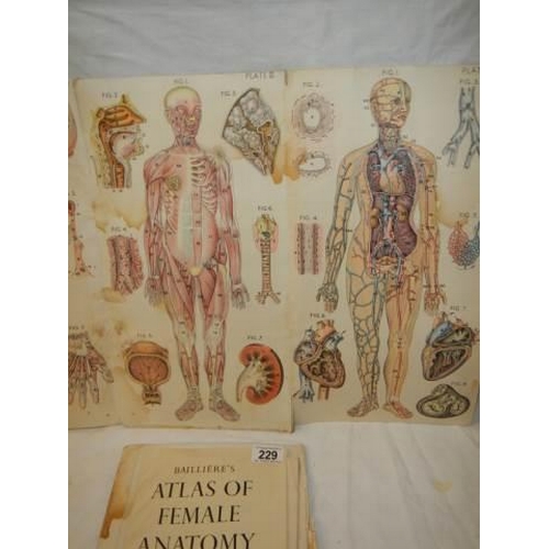 229 - An Atlas of Female Anatomy, in poor condition.