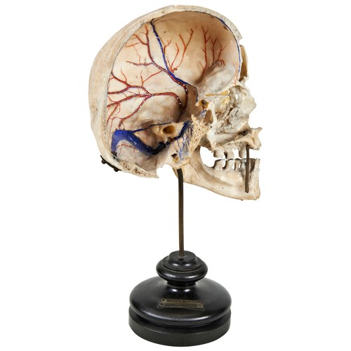 308 - A HUMAN HALF SKULL MOUNTED FOR ANATOMICAL USE, drilled and painted to illustrate vein patterns and m... 