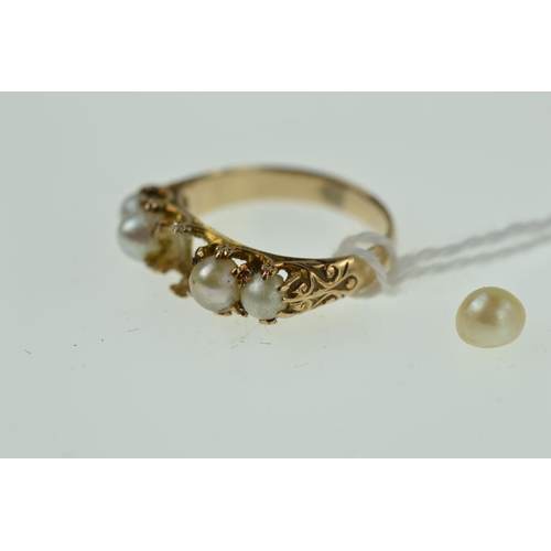 405 - Yellow metal & pearl ring, size L, tests postive for 9ct gold, one pearl loose