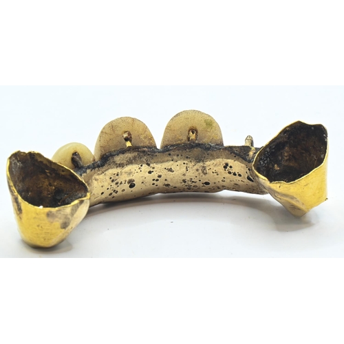 124 - Yellow metal mounted teeth, gross weight 8.56 grams