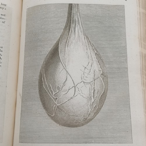 69 - 1775 book The Chirurgical works of Percivall Pott and surgeon to St Bartholomew's hospital & has boo... 