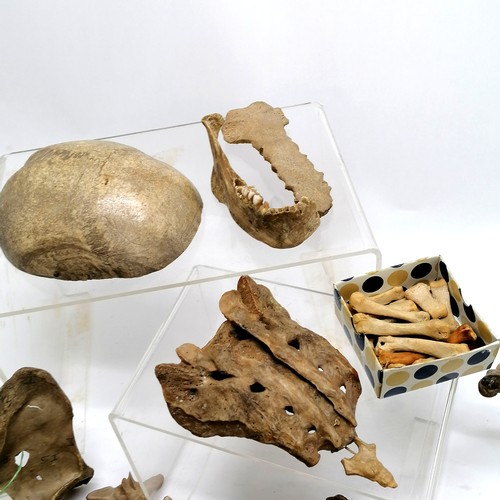 79 - Qty of antique human bones inc cranium, jaw, hand etc - property of a doctor for educational purpose... 