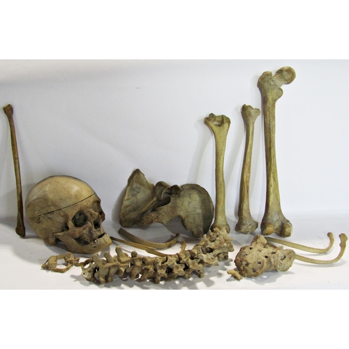 1816 - An early 20th century boxed partial human skeleton including a skull with hinged cranium