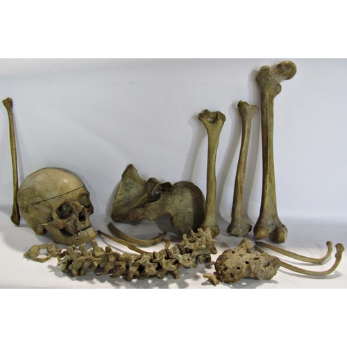 1816 - An early 20th century boxed partial human skeleton including a skull with hinged cranium