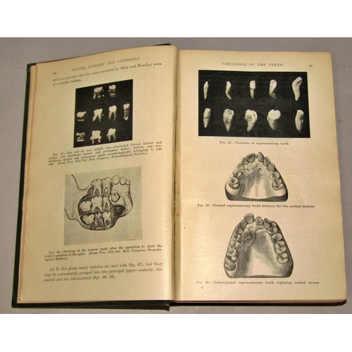 168 - Dentistry Interest - Diseases of the Gums by Goadby, 1923, Dental Surgery 1919, etc, 7 volumes