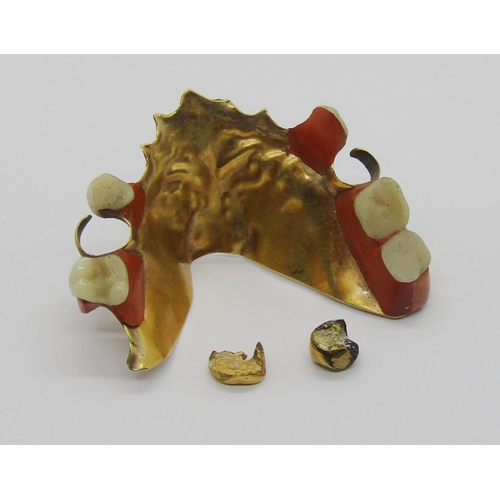 322 - Gold dental plate and two gold crowns, 22.5g gross (3)