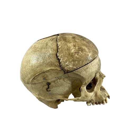 12 - An antique human skull, the cranium cut and hinged for medical education (later glued) (lacking bott... 