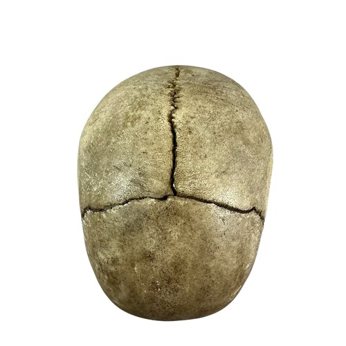 12 - An antique human skull, the cranium cut and hinged for medical education (later glued) (lacking bott... 