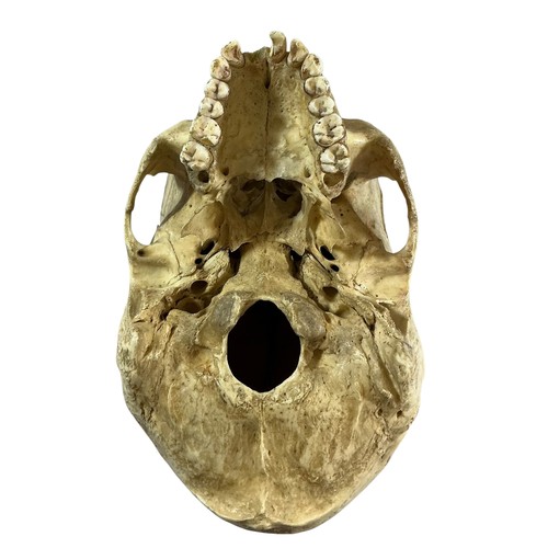 12 - An antique human skull, the cranium cut and hinged for medical education (later glued) (lacking bott... 