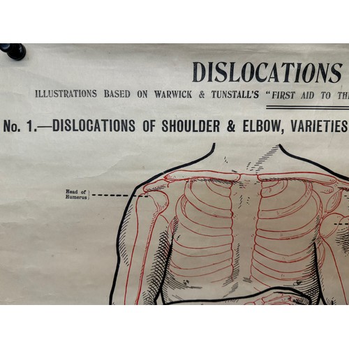 49 - Early C20th linen backed First Aid poster, dislocations and Fractures, 101 cm x 66 cm.

This lot is ... 