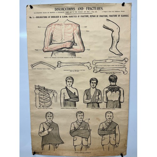 414 - Early C20th linen backed First Aid poster, dislocations and Fractures, 101 cm x 66 cm.

This lot is ... 