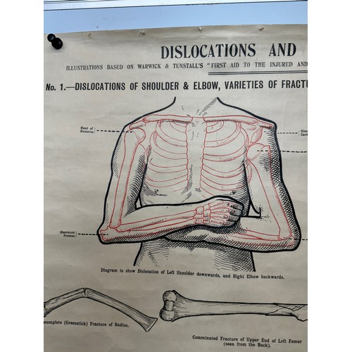 414 - Early C20th linen backed First Aid poster, dislocations and Fractures, 101 cm x 66 cm.

This lot is ... 