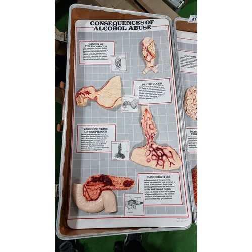 41 - Very rare lockable case from the health education company on the consequences of alcohol abuse. Cont... 