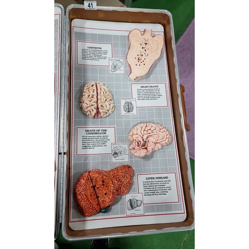 87 - Very rare lockable case from the health education company on the consequences of alcohol abuse. Cont... 