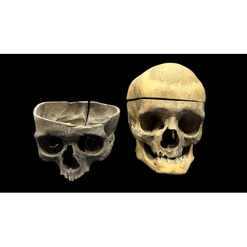 374 - Dental Study - Human Skulls. Believed to have been used for dental medical study/research. One skull... 