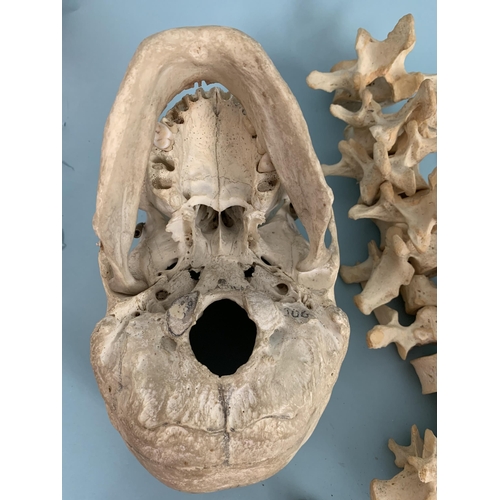 171 - An antique, possibly late 19th/early 20th Century half human skeleton, including a skull with articu... 