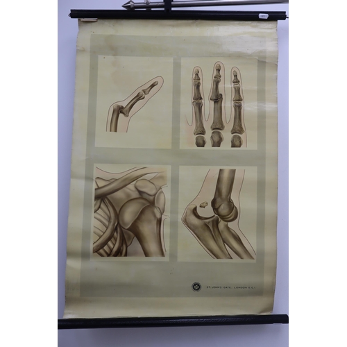 351 - Two St Johns Ambulance 1970s Anatomical Fracture Wall Charts (87cm x 55cm)