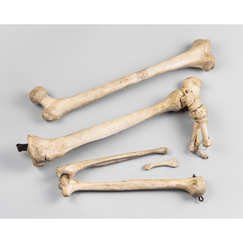 200 - A 19TH CENTURY GROUP OF HUMAN MEDICAL BONES.