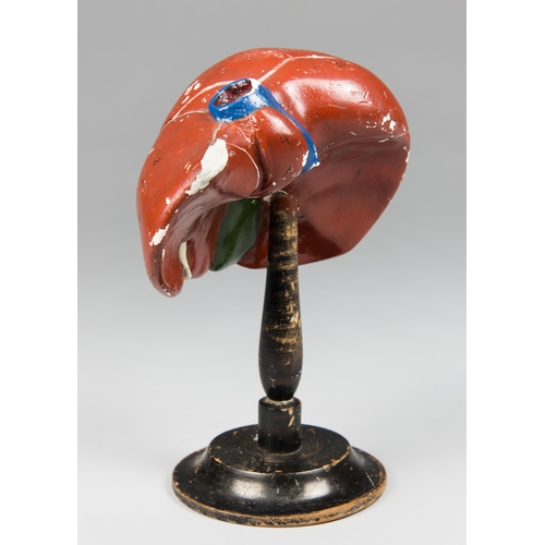 5 - A LATE 19TH CENTURY GERMAN ANATOMICAL MODEL OF A LIVER ON AN EBONISED STAND.
The cast and moulded po... 