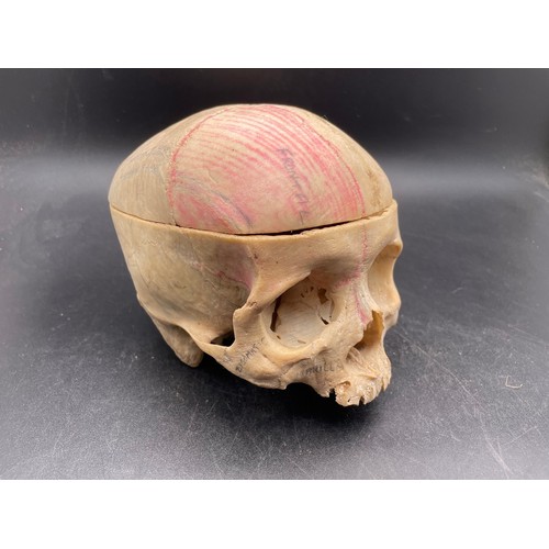 225 - Authentic human skull, spinal cord and bones. Used for medical purposes