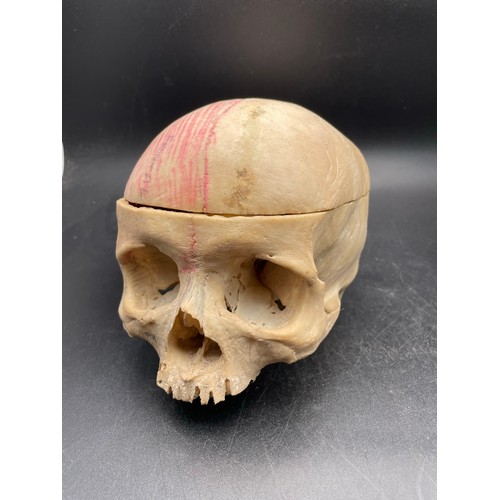 225 - Authentic human skull, spinal cord and bones. Used for medical purposes