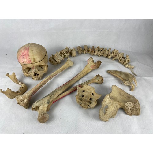 225 - Authentic human skull, spinal cord and bones. Used for medical purposes