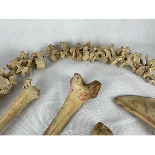 225 - Authentic human skull, spinal cord and bones. Used for medical purposes