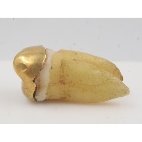 35 - 14ct gold crown affixed to tooth. UK P&P Group 0 (£6+VAT for the first lot and £1+VAT for subsequent... 