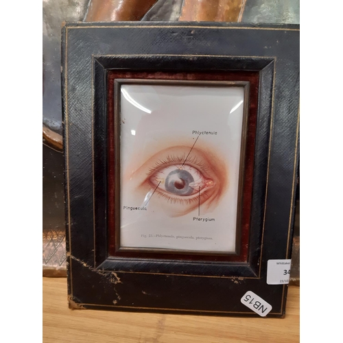 346 - A Victorian blue leather photo frame with anatomical eye print