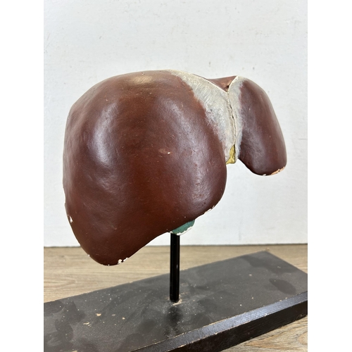 670A - A 1930s Librairie Hatchette Paris human liver plaster anatomical study on ebonised plinth - approx. ... 