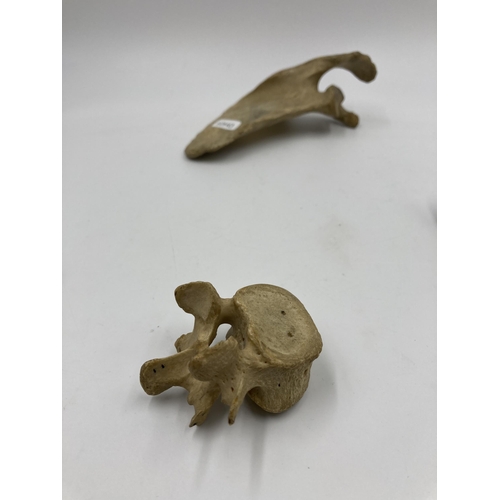 561 - Three human anatomical bone fragments