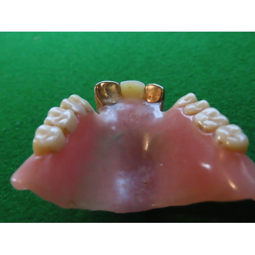 766 - Two Gold Dental Crowns on Lower Set of False Teeth Good Gold Content Owner Now Deceased