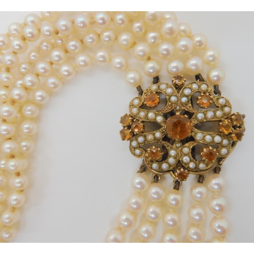 546 - A FIVE STRAND PEARL NECKLACE WITH A 9CT CITRINE AND PEARL CLASP