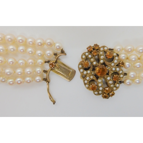 546 - A FIVE STRAND PEARL NECKLACE WITH A 9CT CITRINE AND PEARL CLASP