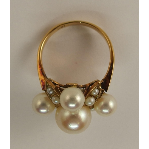 690 - An 18ct gold pearl dress ring