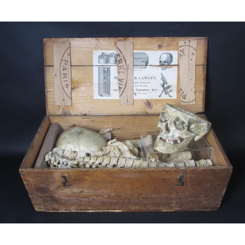 655 - A human half skeleton in original pine box