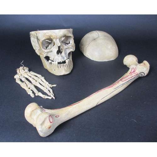 655 - A human half skeleton in original pine box