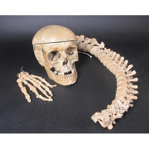 655 - A human half skeleton in original pine box