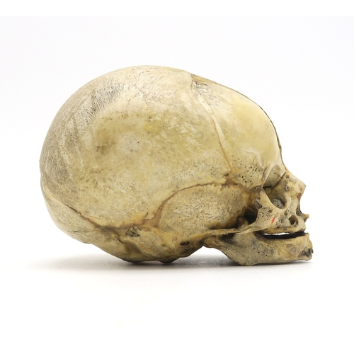 2602 - A HUMAN SKULLSupplied by Maison Tramond of 9 Rue de L'Ecole de Medicine, Paris, measuring approx. 9c... 