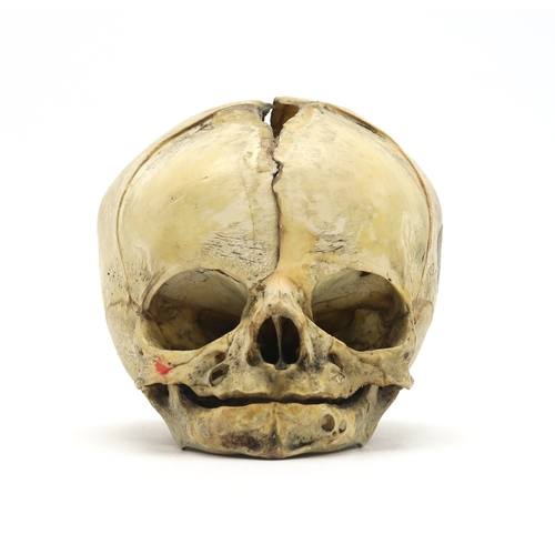 2602 - A HUMAN SKULLSupplied by Maison Tramond of 9 Rue de L'Ecole de Medicine, Paris, measuring approx. 9c... 