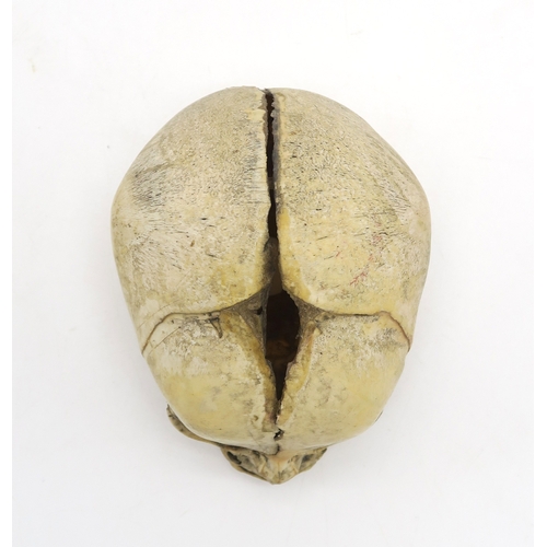 2602 - A HUMAN SKULLSupplied by Maison Tramond of 9 Rue de L'Ecole de Medicine, Paris, measuring approx. 9c... 